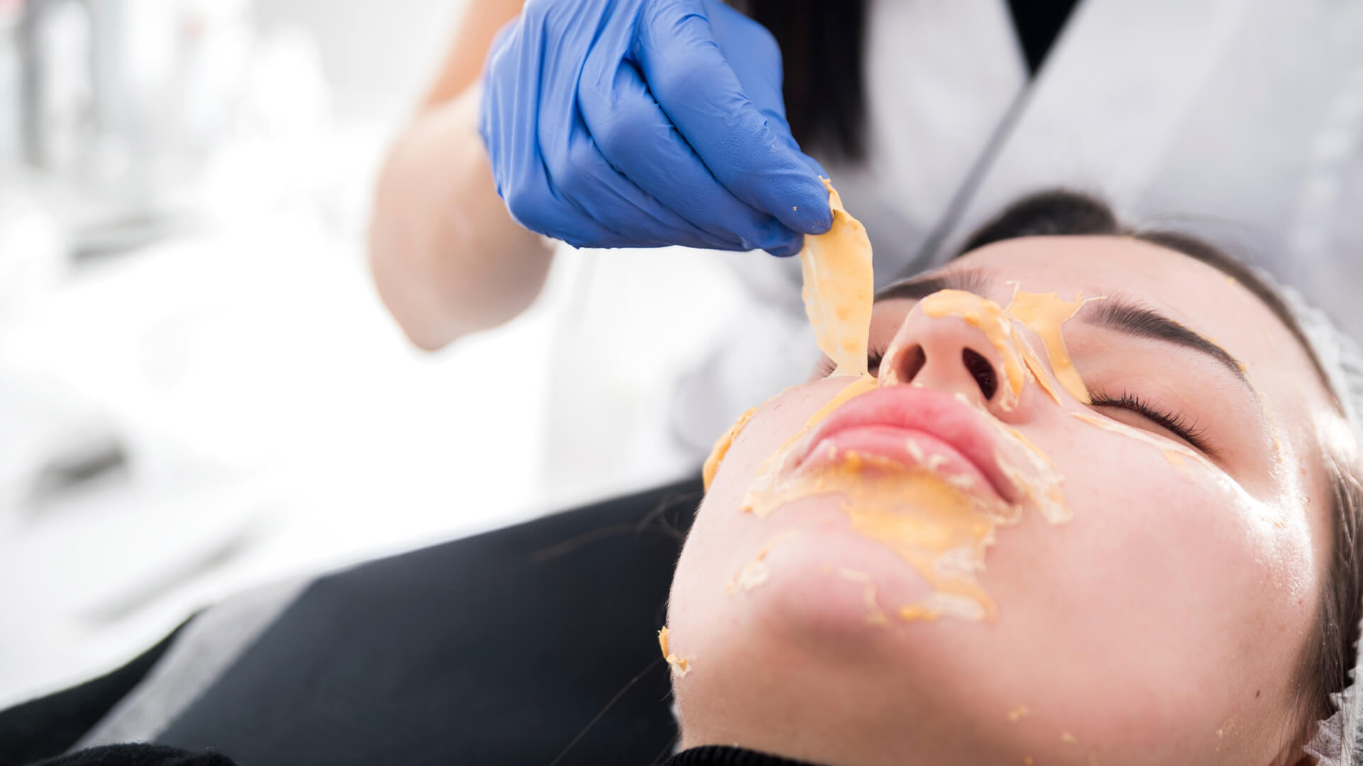 Peeling Uygulamaları